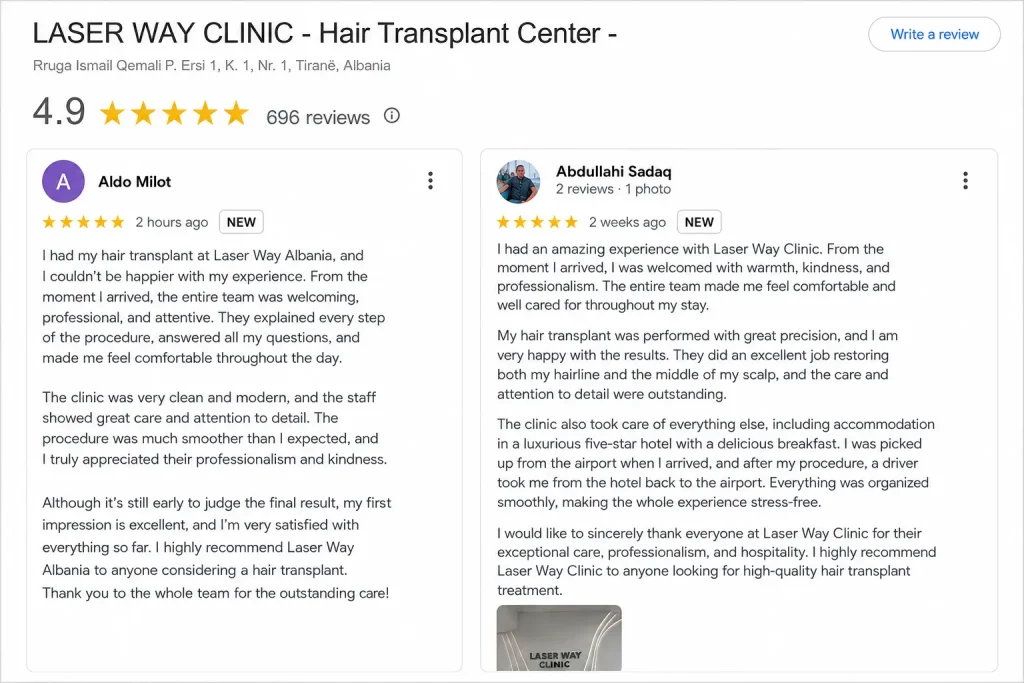 laser way reviews