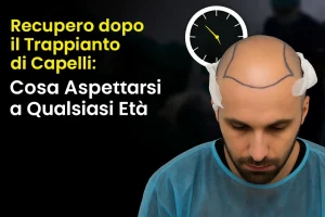 Recupero dopo il Trapianto di Capelli Cosa Aspettarsi a Qualsiasi Età