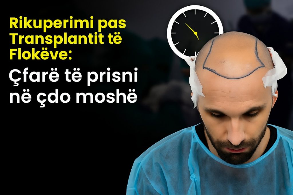 Rikuperimi pas Transplantit të Flokëve