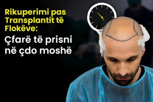 Rikuperimi pas Transplantit të Flokëve