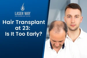 Thinking about a hair transplant at 23