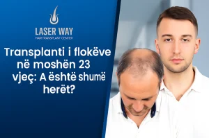 Transplanti i flokëve në moshën 23 vjeç: A është shumë herët