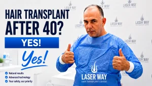 Hair Transplant After 40 Absolutely.