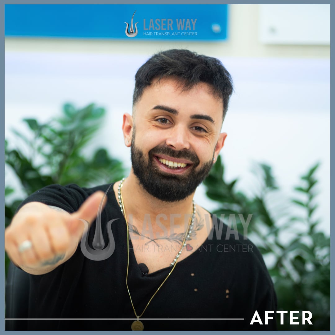 alfio after 2