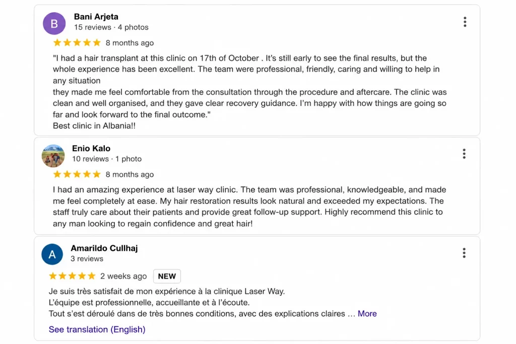 laser way review