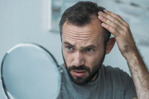 Early Signs of Progressive Hair Loss