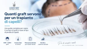 Numero di graft necessari per un trapianto di capelli e pianificazione personalizzata